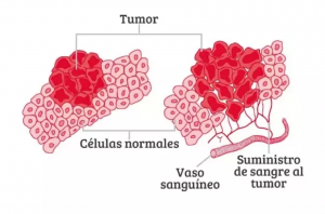 Cáncer