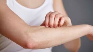 Enfermedades dermatológicas