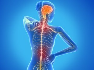Esclerosis múltiple