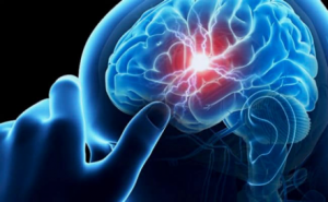 convulsionesfocales_cannabis